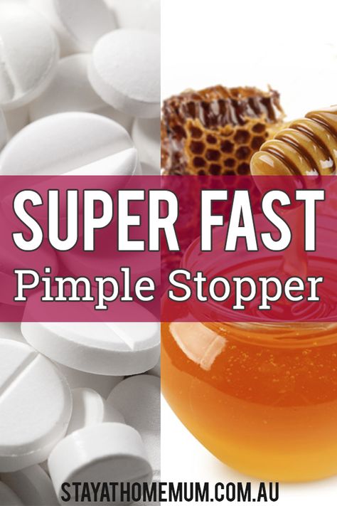 As a grown up who has suffered with acne my whole life, I'm giving this super fast pimple stopper, the old fashioned Aspirin Face Mask a go to try to get rid of those pesky zits. Asprin Face Mask Acne, Asprin Face Mask, Aspirin Face Mask, Pimple Under The Skin, Face Masks For Acne, Masks For Acne, Blind Pimple, Face Mapping Acne, Pimples Under The Skin