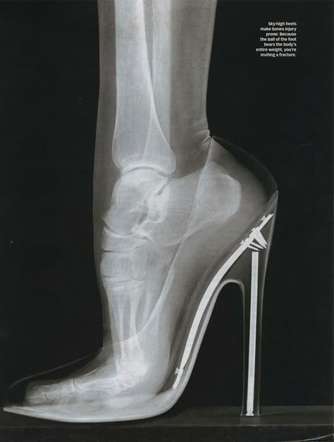 Alexander Technique, Stiletto Shoes, X Ray, Beauty Trends, Black Outfit, Designer Shoes, Ballet Shoes, Fashion Models, Wedding Shoe