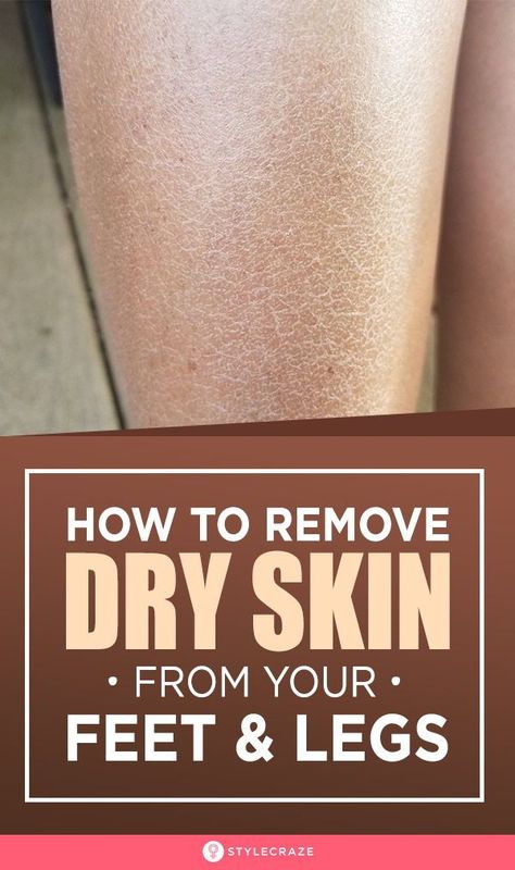 How To Remove Dry Skin From Your Feet And Legs: Is the dry, flaky skin on your feet and legs irritating you? Then, come aboard and resolve this skin issue with the remedies in this article. #Beauty #BeautyTips #DrySkin Dry Skin Legs, Dry Legs, Dry Skin Care Routine, Dry Flaky Skin, Skin Care Routine For 20s, Dry Skin Remedies, Dry Skin Care, Flaky Skin, Skin Remedies