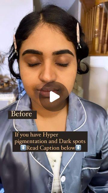 ATLANTA MAKEUP ARTIST & HAIR | SHAZMIN on Instagram: "“Hey, girlies! 🌟 When dealing with dark spots, hyperpigmentation, and dark circles, especially when you’re DIY glamming up for special occasions, follow these steps:

1. Start by hydrating dry spots with a rich, creamy moisturizer wait let it sink in and go in with your primer.
2. Apply  an orange color corrector matching the darkness of the spot. (The darker the spot- the darker the orange corrector)
3. Follow up with full-coverage foundation, possibly layering for better coverage.
4. Set your makeup with translucent powder and setting spray for that flawless finish! 💄✨”

Follow the same thing for dark circles but go in with your lighter shade of concealer after the foundation.
.
.
SAVE THIS REEL FOR LATER ✅
FOLLOW FOR MORE ✅
Dm me i Atlanta Makeup, Orange Color Corrector, Full Coverage Foundation, Translucent Powder, Color Corrector, Sink In, Setting Spray, The Darkness, The Spot