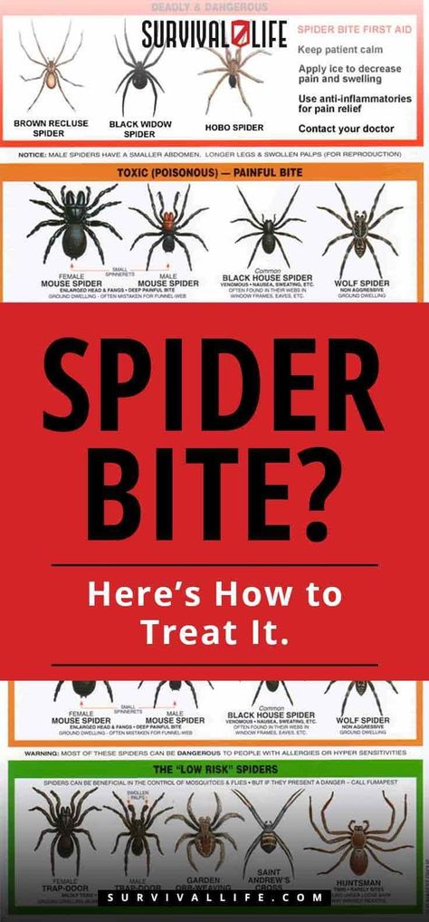 ðŸ•·ðŸ•¸â›‘Spider bites can be deadly and painful. ðŸ˜² Hereâ€™s How To Treat It.ðŸ‘ðŸ¼ #spider #spiderbites #outdoorskills #outdoors #bushcraft #survivaltips #survivalskills #survivalkit Spider Bites Remedies, Treating Spider Bites, Black House Spider, Spider Bite Symptoms, Spider Bites Pictures, Spider Repellant, Recluse Spider Bite, Brown Recluse Spider Bite, Hobo Spider