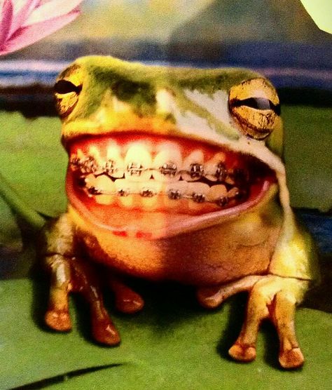 FUNNY BRACES FROG Humour, Funny Dental Humor, Orthodontic Humor, Braces Humor, Dental Funny, Braces Smile, Kids Braces, Cute Braces, Dental Fun