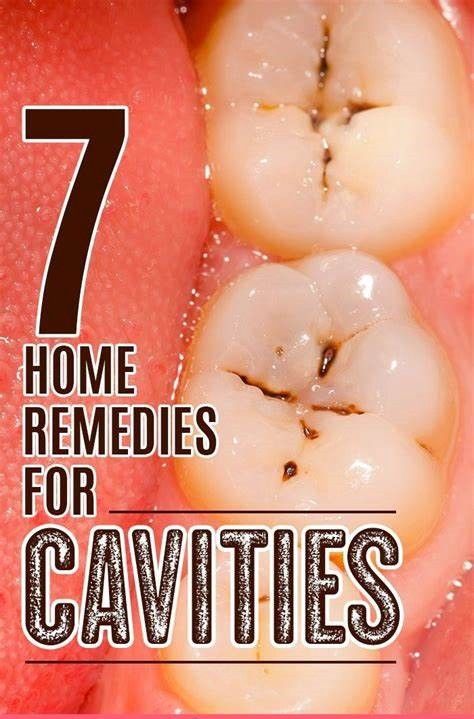 7 Home Remedies For Cavities Home Remedies For Cavities, Cavity Remedy, Reverse Cavities, Health Articles Wellness, Oral Care Routine, Gum Care, Receding Gums, Oral Health Care, Tooth Decay