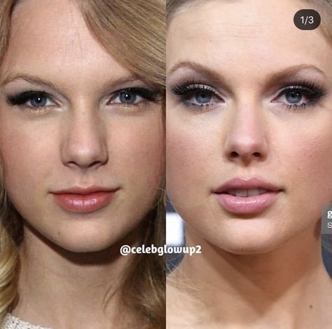 Celebrity Before And After, Celebrity Before And After Surgery, Celebrities Before And After Surgery, Sea Before And After Surgery, Taylor Swift Before And After, Taylor Swift Nose Job, Canthoplasty Before And After, Nose Plastic Surgery Before After, Before And After Plastic Surgeries