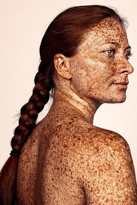 These Photos of Freckles Will Make You Love Your Spots Even More People With Freckles, Beautiful Freckles, Freckle Face, Unique Faces, Popsugar Beauty, Interesting Faces, Redheads, Red Hair, Pretty People