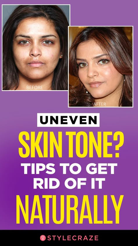 Even Tone Skin Diy, How To Get Even Skin Tone On Face Naturally, Best Skin Care Products For Uneven Skin Tone, Tips For Even Skin Tone, Skincare Routine For Uneven Skin Tone, Skin Care For Even Skin Tone, Diy Face Mask For Even Skin Tone, Face Mask For Even Skin Tone, How To Even Your Skin Tone