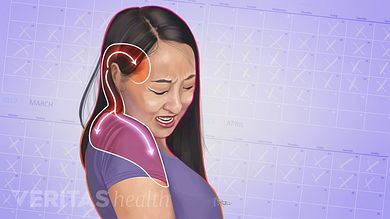 Tmj Headache, Severe Neck Pain, Neck Headache, Forward Head Posture Exercises, Headache Causes, Neck And Shoulder Muscles, Chronic Back Pain, Neck Problems, Forward Head Posture