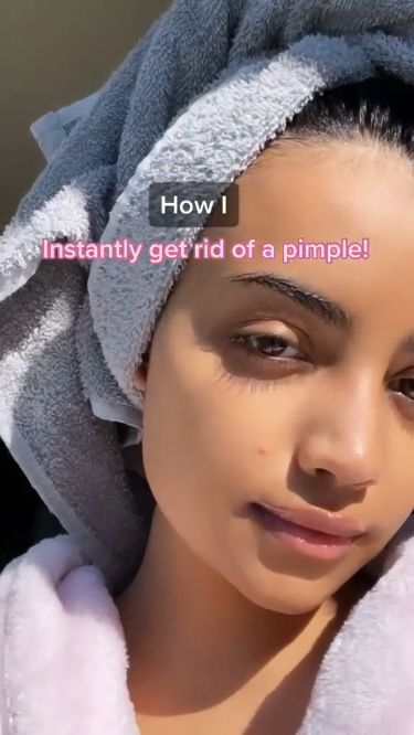 Pimple Problems No More: Your Guide to Pain-Free Skin How To Treat Pimples, Natural Remedies For Acne, Pimple Free Skin, Acne Beauty, Remedies For Acne, Pimples Remedies, Clear Glowing Skin, Natural Acne Remedies, Clear Complexion