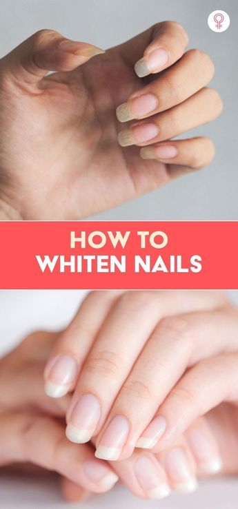 How To Whiten Nails, Make Nails White, Natural Nail Tips, Nail Whitening, Nail Remedies, Nail Growth Tips, Nail Care Routine, Nail Care Tips, Nail Growth