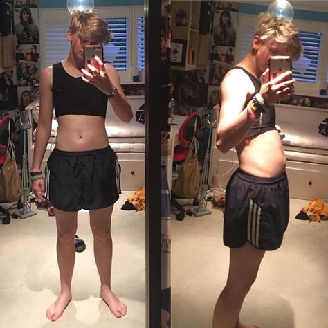 Found these old pics of me with a food baby 😍 I’ve named her Shakira. GONNA GO ON YOUNOW IN 30 MINUTES! Gonna do my T shot and give u guys updates on where I am regarding testosterone and top surgery so... if you’re interested, my YouNow is Noahfinnce Ftm Swimwear, Top Surgery Ftm, Noah Finnce, Miles Mckenna, Trans Masc, Top Surgery, Alex Kingston, Old Pics, I M Sick