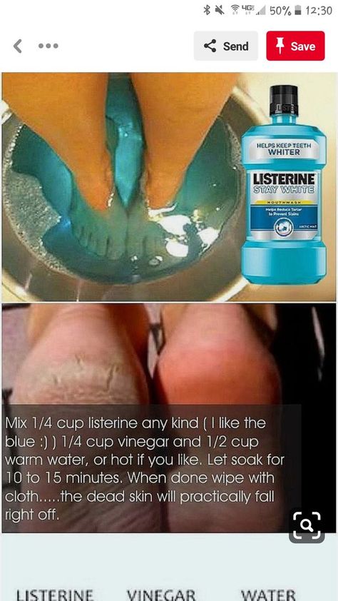 Homemade Foot Cream, Dry Feet Remedies, Skin Care Diy, Foot Soak Recipe, Diy Pedicure, Natural Skin Care Ingredients, Natural Skin Care Remedies, Nail Care Routine, Skin Remedies