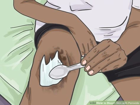 How To Bleach Skin, Bleach Skin, Dark Patches On Skin, Bleaching Your Skin, Face Mask Cream, Skin Lightening Diy, Dark Inner Thighs, Body Bleaching, Peroxide Uses