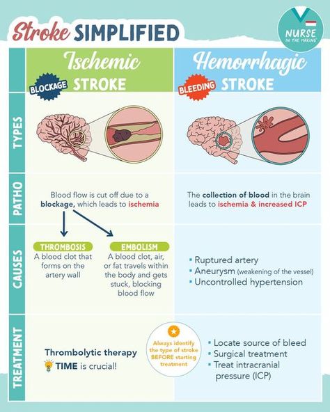 Ischemic Strokes, Medical Slp, Types Of Strokes, Intracranial Pressure, Neurological System, Medicine Notes, Medical Procedures, Severe Headache, Sciatic Nerve Pain