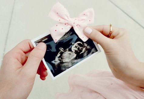 Instagram Gender Reveal Photo, Simple Gender Reveal Photo Ideas, Gender Reveal Social Media Photo Ideas, Gender Reveal Photoshoot With Siblings, Gender Announcement Pictures, Gender Reveal Photoshoot Ideas, Gender Reveal Photo Ideas, Foto Gender Reveal, Gender Reveal Photoshoot