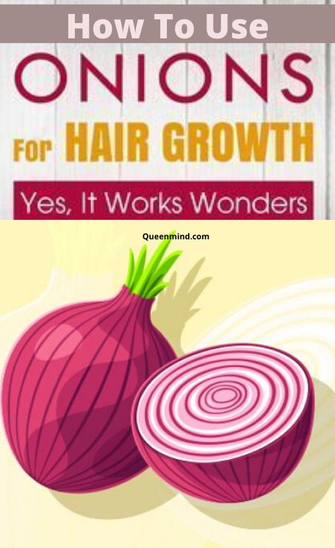 Prevent Gray Hair, Onion Juice For Hair Growth, Juice For Hair Growth, Onion Hair Growth, Juice For Hair, Onion Juice For Hair, Prevent Grey Hair, Rapid Hair Growth, Onion For Hair