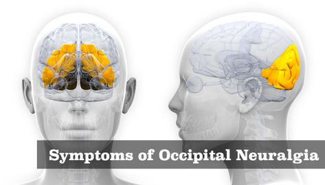 Occipital Neuralgia Symptoms, Occipital Neuralgia Relief, Occipital Nerve Block, Pinched Nerve In Neck, Neck Headache, Nerve Disorders, Forward Head Posture Exercises, Myofascial Pain Syndrome, Occipital Neuralgia