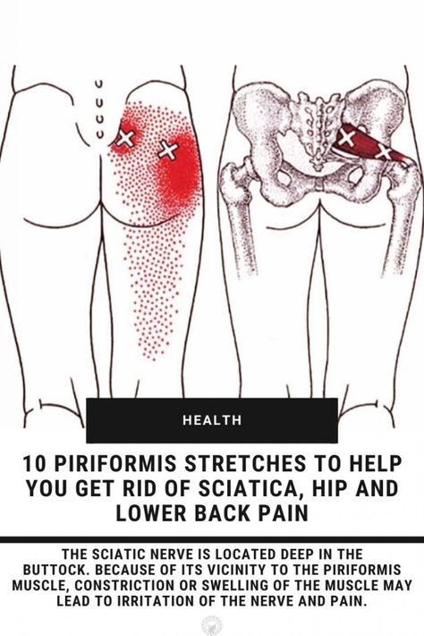 Sciatic Nerve Exercises, Sciatica Stretches, Piriformis Muscle, Hip Pain Relief, Piriformis Stretch, Sciatica Exercises, Piriformis Syndrome, Sciatica Pain Relief, Nerve Pain Relief