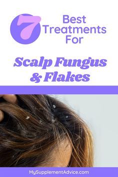 Learn 7 best treatments for scalp fungus and flakes that will improve your scalp health immediately. Salt Scrub For Scalp, Scalp Oil For Dry Scalp, How To Improve Scalp Health, Oils For Scalp Health, Acv Scalp Cleanse, Hair Care Routine For Oily Scalp And Dry Ends, Scalp Excema, Sebboric Dermitis Scalp, Scalp Cleanser Diy