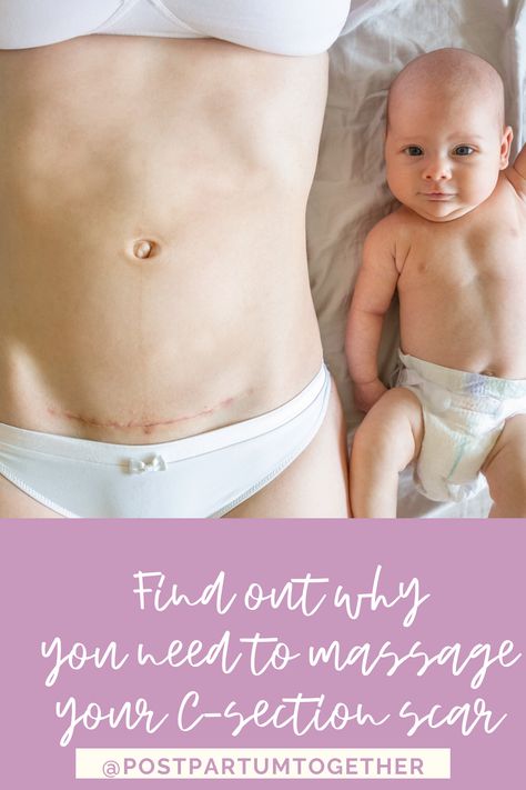 Postpartum Preparation, Belly After Baby, Scar Massage, C Section Scar, Perineal Massage, Birth Tips, C Section Scars, Birth Recovery, Birth Preparation