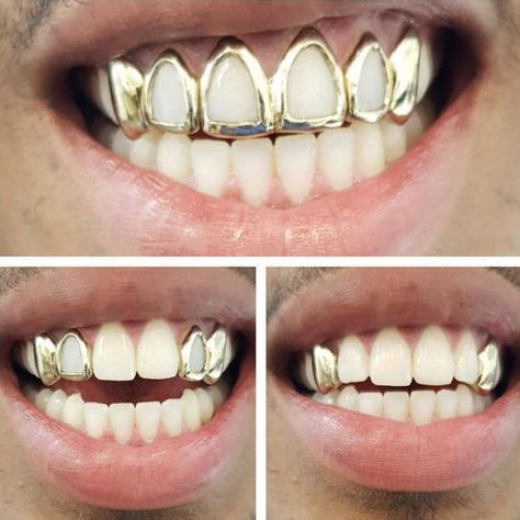 Silver Teeth Caps, Window Caps Teeth, Window Grillz Teeth, Female Grills Teeth Gold, Silver Caps On Teeth, Gold Caps Teeth, Women Grills Teeth, Grills Teeth Men, Silver Grillz Men