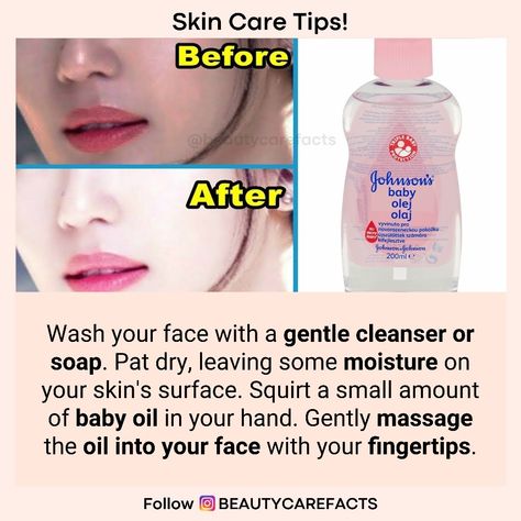 Get Crystal Clear Skin . . Follow beautycarefacts for natural beauty and health tips. . . Share with your friend👱👱‍♀️ or tag 😉 Double tap❤️ for more info🗣️ share + Tag your Friends. Follow beautycarefacts For Daily beauty and health remedies💯💯 #healthtipsforwomen #healthtipsdaily #healthtips #healthtipsoftheday #beautyremedies #beautycare #beautytips4you #homebeautytips #diybeautytips #naturalbeautytips #tipsbeauty #beautytips #healthremedies #healthylifestyle Crystal Clear Skin, Pimple Solution, Home Beauty Tips, Health Tips For Women, Beauty And Health, Beauty Remedies, Diy Beauty Hacks, Gentle Cleanser, Natural Beauty Tips