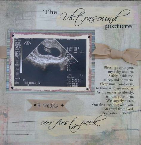 Ultrasound Scrapbook, Baby Scrapbook Ideas, Scrapbook Baby Book Ideas, Pregnancy Scrapbook, Baby Book Pages, Baby Books Diy, 3d Ultrasound, Scrapbook Page Ideas, Boy Scrapbook Layouts