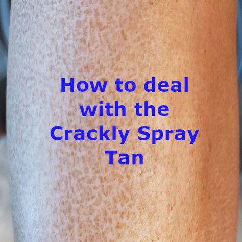 How to prevent and fix CRACKED Spray Tans Mobile Spray Tanning Business, Bad Spray Tan, Spray Tan At Home, Norvell Spray Tan, Spray Tan Room, Spray Tan Booth, Spray Tan Marketing, Spray Tanning Quotes, Spray Tan Machine