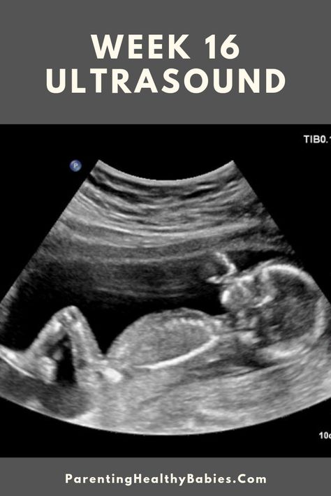 15 Weeks Pregnant Facts, 22 Week Ultrasound, 17 Weeks Pregnant Ultrasound, 15 Week Ultrasound, Boy Ultrasound Pictures, 4d Ultrasound Pictures, Ob Ultrasound, Boy Ultrasound, Fake Ultrasound