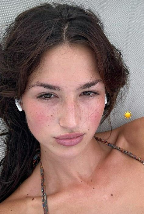 Bare Skin Aesthetic, Sunburn Aesthetic Face, Simple Sunkissed Makeup, Sunburnt Face Aesthetic, Clear Skin With Freckles Aethstetic, Sunkissed Skin Aesthetic, Bare Face Girl, Bare Face Aesthetic, Sunburnt Makeup Look