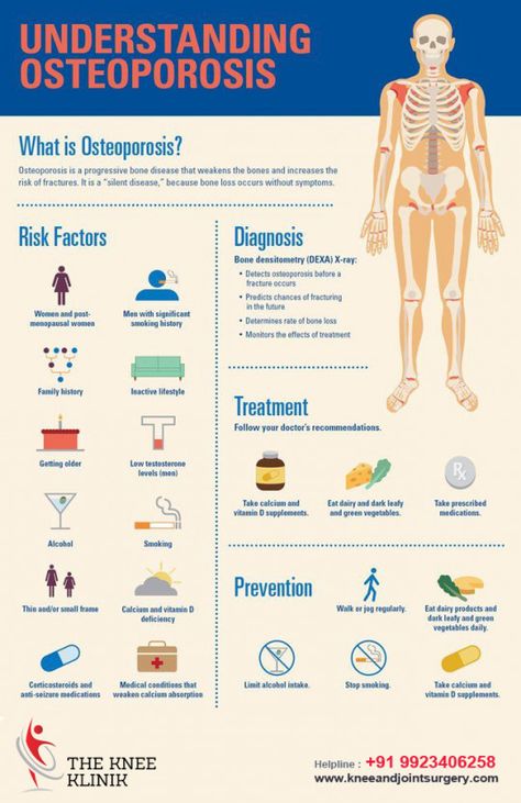 Best Foods For Healthy Bones - Osteoporosis Nursing, Osteoporosis Symptoms, Osteoporosis Exercises, Bone Diseases, Bone Loss, Health Screening, Bone Density, Nursing Notes, Healthy Bones