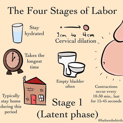 Early Labor, Birth Education, Birth Preparation, Stages Of Labor, Pregnancy Labor, Newborn Mom, Mom Needs, Baby Life Hacks, Pregnancy Advice