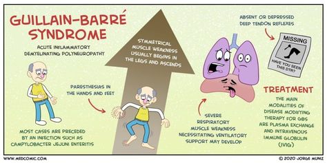 Learn about Guillain-Barré syndrome with a Medcomic rap Guillain Barre, Guillain Barre Syndrome, Med Surg Nursing, Nursing Mnemonics, Pa School, Respiratory Therapy, Medical School Studying, Medical Examination, Nursing Tips