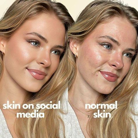 Filter Is Not Real Life Real Skin Texture, Face Mapping Acne, Eyeliner Techniques, Real Skin, Celebrity Skin, Swag Girl Style, Healthy Skin Tips, Face Acne, Perfect Relationship