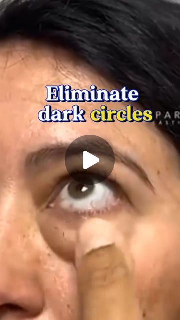 Home Remedies on Instagram: "Easiest remedy for reducing under eye dark circles, inder eye puffiness naturally & permanently. Prepare this magic for your eyes Eliminate Dark Circles and Under Eye Bags with this Natural Recipe  #darkcircles #undereyebags  #beautifulskin  #insomia #naturalremedy  #naturalremedieswork  #naturalremedy #naturalremedies #recipe #usa #remedy #reels   #undereyedarkcircles  #darkcirclesbegone #undereyecircles  #undereyepuffiness #skincare  #skincarecommunity #skincarelover #skinlove #skingoals" Under Eye Bags Remedies, Bumps Under Eyes, Under Eye Dark Circles, Eye Dark Circles, Remove Eye Bags, Medical Tips, Eye Puffiness, Dark Eye Circles, Face Care Tips