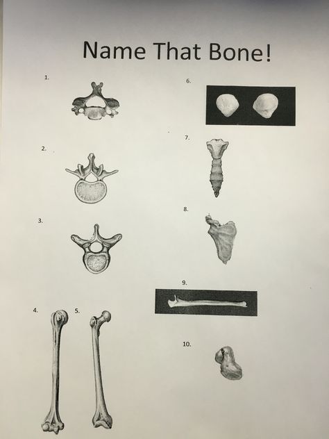 "Name That Bone" for NRTW! Winners from day and night shift get a door prize :) Radiology, rad tech week, national radiologic technology week Rad Tech Party Ideas, Radiology Day Celebration Ideas, Radiology Day Ideas, Radiology Tech Week Games, Radiology Tech Week Ideas, Rad Tech Week Games, Rad Tech Week Ideas, Radiology Day, Grad Games