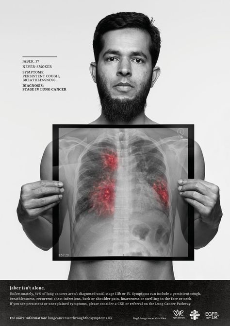 Integrated Advert By Engine Group: See through the symptoms | Ads of the World™ Healthcare Ads, Health Ads, Chest Infection, Lungs Health, Publicidad Creativa, Ad Creative, Body Organs, Creative Ads, Print Ad