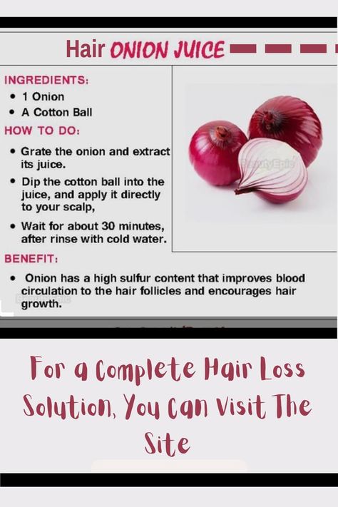 Onion Juice For Hair Fall - How To Apply Onion Juice On Hair Onion Hair Growth, Juice For Hair, Onion Juice For Hair, Hair Fall Solution, Hair Growth For Men, Onion For Hair, Onion Juice, Hair Remedies For Growth, New Hair Growth