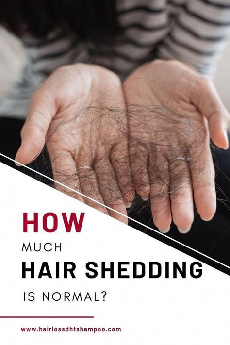 How To Stop Hair Shedding, Hairloss Hairstyles, Hair Shedding Remedies, Healthy Natural Hair Growth, How To Grow Natural Hair, Hair Growth Supplement, Excess Hair, Hair Shedding, Lost Hair