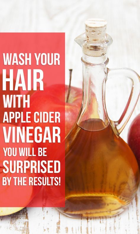 Apple Cider Vinegar Hair Rinse, Vinegar For Hair, Vinegar Hair Rinse, Apple Cider Vinegar Rinse, Apple Cider Vinegar For Hair, Vinegar Rinse, Costume Noir, Cold Sores Remedies, Natural Sleep Remedies