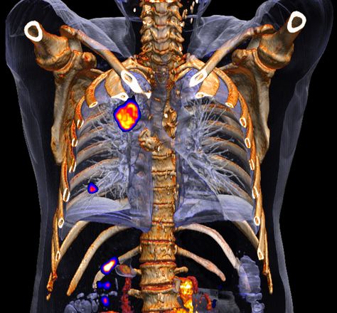 newest type of pet scan - Google Search Pet Scan Image, Computed Tomography, Pet Ct, Radiology Imaging, Pet Scan, Radiation Exposure, Nuclear Medicine, Data Quality, Food Signs