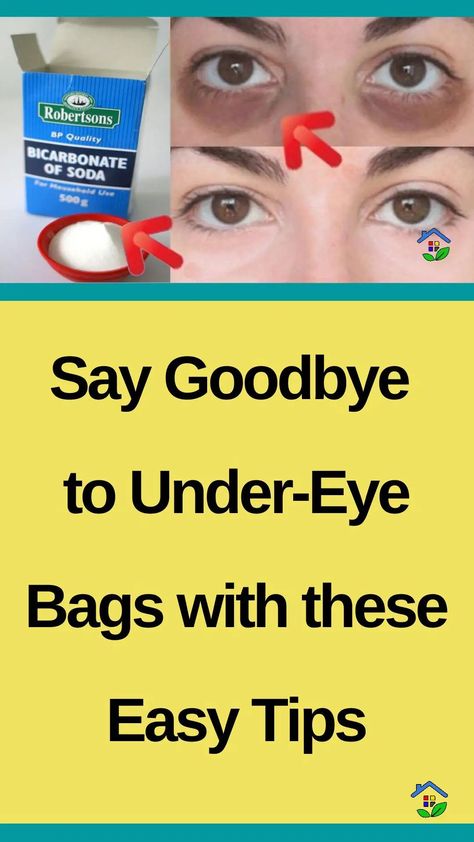 Dark circles under your eyes make you look tired and worn out. We already know that You have tried so many remedies in vain, and for that, we are here to help. Each remedy has its undesirable side effects, but have you ever thought about baking soda? This time, we have chosen a natural remedy […] Baking Soda For Eye Bags, Black Under Eyes Get Rid Of, Baking Soda Under Eyes, Carpet Smell, Baking Soda Benefits, Turmeric Vitamins, What Makes You Unique, Dark Circles Under Eyes, Healthy Eyes