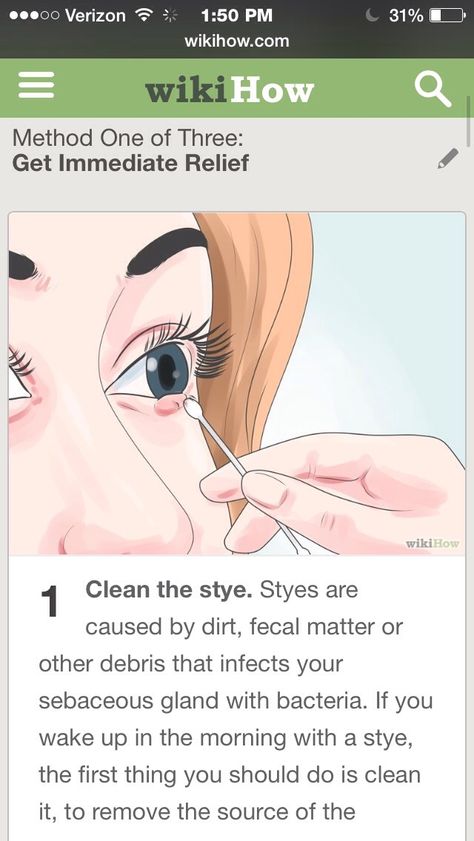 "How To Get Rid Of A Stye"http://m.wikihow.com/Get-Rid-of-a-StyeGo to link for full description.👌Go to link for full description.👌Go to link for full description.👌Go to link for full description.👌Go to the link for full description, because this really helped me!!!👌👍 Please like before you save!!!☺️👌 How To Treat A Stye In Your Eye, Stye Remedies, Stye Remedy, Eye Stye Remedies, Swollen Eyelid, Warts On Face, Get Rid Of Warts, Natural Sleep Remedies, Natural Health Care