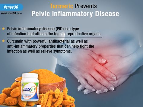 Pelvic inflammatory disease (PID) is a type of infection that affects the female reproductive organs. Curcumin with powerful #antibacterial as well as anti-inflammatory properties that can help fight the infection as well as relieve symptoms. #curcumin #turmeric #snec30 #antiinflammatory  https://www.snec30.com/ Pid Symptoms, Female Problems, Pelvic Inflammatory, Alternative Medicine, Body Health, Healthy Body, Immune System, Disease, Medicine