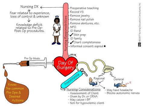 Day of Surgery Med Surge, Nurse Education, Perioperative Nursing, Nursing Information, Operating Room Nurse, Med Surg Nursing, Nursing Process, Nursing Mnemonics, Nurses Station