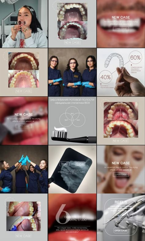 Dental Clinic Instagram Post, Dental Clinic Aesthetic, Dentist Instagram Feed, Dental Social Media Design, Dentist Social Media, Health Preschool, Dental Health Preschool, Dental Branding, Dental Ideas