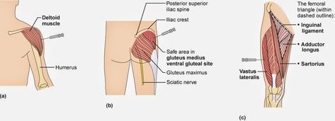 vitamin b12 injection sites Gluteal Injection Site, Intramuscular Injection Sites, Depo Injection, Im Injection Sites, Vitamin B Injections, Vitamin Injections, Injection Sites, Im Injection, Vitamin B12 Injections