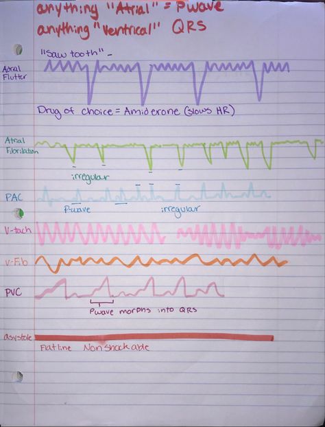 Cardiac Arrhythmias Nursing, Med Surg Nursing Cardiovascular, Med Surg Cardiovascular, Med Surg 2 Nursing, Nursing School Med Surg, Med Surg Cardiac, Cardiac Assessment Nursing, Peds Cardiac Nursing, Cardiac Rhythms Cheat Sheets