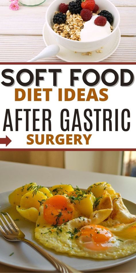 Soft Food Ideas After Gastric Bypass Surgery Soft Foods Recipes After Surgery, Soft Food Dinners, Soft Food Ideas, Sleeve Surgery Diet, Soft Food Diet, Bariatric Recipes Sleeve Liquid Diet, Soft Foods To Eat, Gastric Surgery, Bariatric Recipes Sleeve