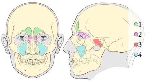 Sinus Relief Remedies, Natural Sinus Relief, Bowen Therapy, Blocked Sinuses, Paranasal Sinuses, Maxillary Sinus, Sinus Cavities, Sinus Infection Remedies, Chronic Sinusitis