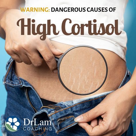 Do you feel constantly stressed and overwhelmed? Have you noticed strange symptoms such as increased sweating and weight gain? These issues could be linked to a medical condition known as high cortisol levels. If you would like to learn more about the causes, testing and care options for high cortisol levels, read the article to discover how to manage this condition. #highcortisol #cortisol #hormones #hormonalimbalance #stress #adrenalfatigue #drlamcoaching Managing Cortisol Levels, High Cortisol Levels, Symptoms Of High Cortisol, High Cortisol, Adrenal Health, Medical Tests, Fatigue Syndrome, Cortisol Levels, Adrenal Fatigue